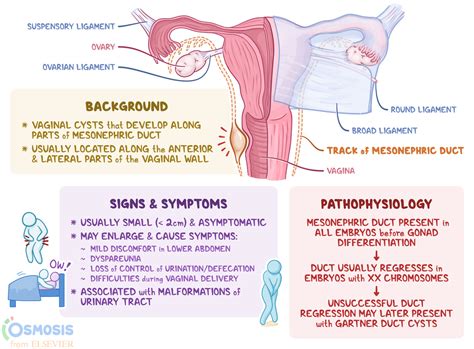 Skenes Gland: What Theyre For, Cyst Symptoms & Treatment